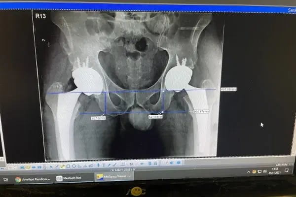Op. Dr. Volkan Güneş, Ortopedi Ve Travmatoloji - Resim 5
