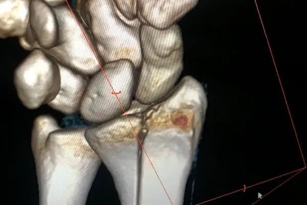 Dr. Öğr. Üyesi BURAK ÇAĞRI AKSU - Ortopedi ve Travmatoloji Uzmanı - Resim 9