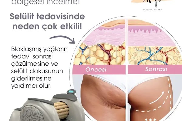 Al-Fe Güzellik Merkezi - Resim 2