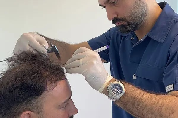 Dr.Gökeşme Hair Transplant - Resim 15