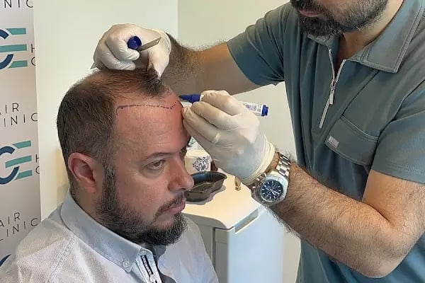 Dr.Gökeşme Hair Transplant - Resim 14