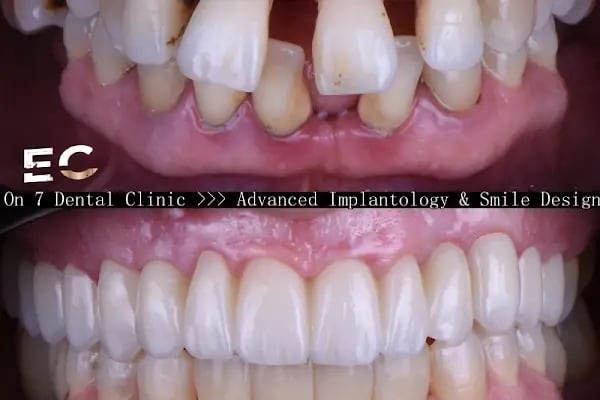 ON7 Dental Clinic- Özel On7 Ağız Diş Sağlığı Polikliniği - Resim 3