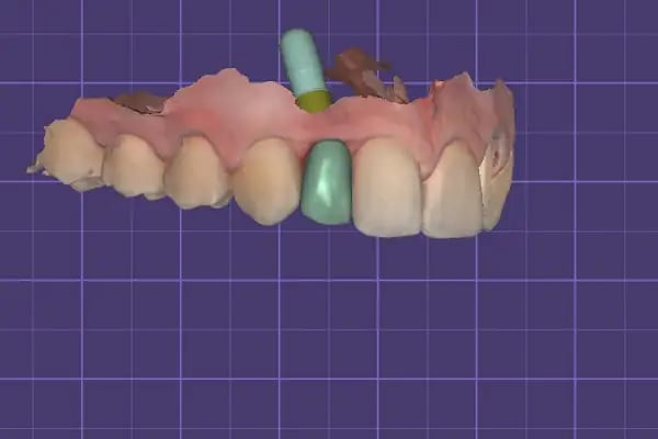 ON7 Dental Clinic- Özel On7 Ağız Diş Sağlığı Polikliniği - Resim 14