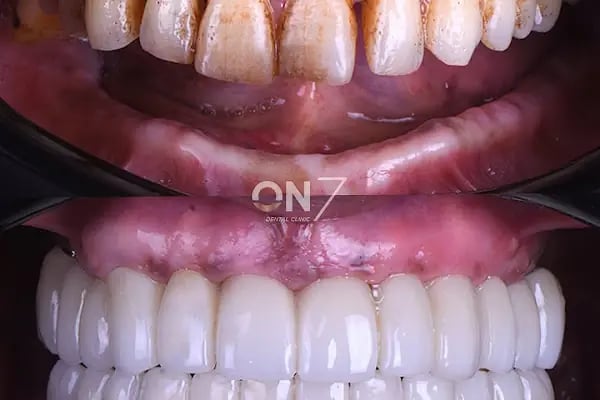 ON7 Dental Clinic- Özel On7 Ağız Diş Sağlığı Polikliniği - Resim 16
