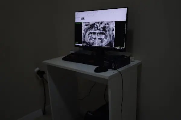Özel Sanat Dent Ağız ve Diş Sağlığı Polikliniği - Resim 12