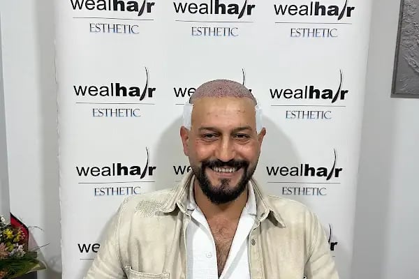 Esteweal Hair Clinic Saç Ekimi - Resim 9