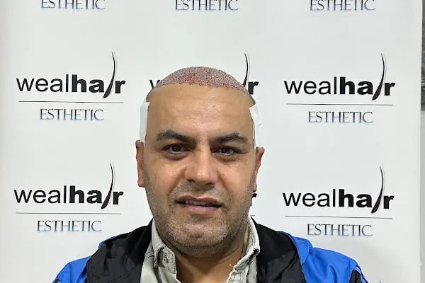 Esteweal Hair Clinic Saç Ekimi - Resim 17
