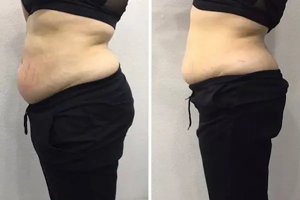 Aris Ezgi Doğan Malatya VIP Güzellik Merkezi - Resim 7