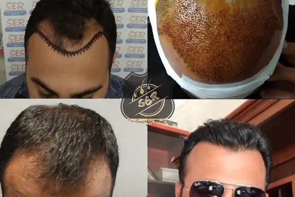 Ser Hair Center - Resim 13