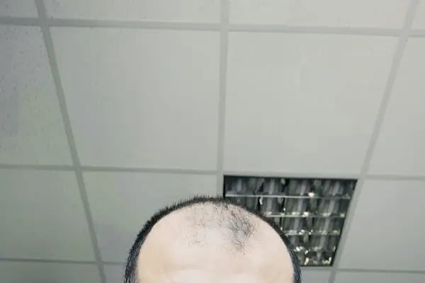 Ser Hair Center - Resim 8