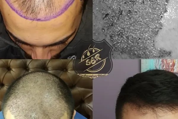 Ser Hair Center - Resim 2