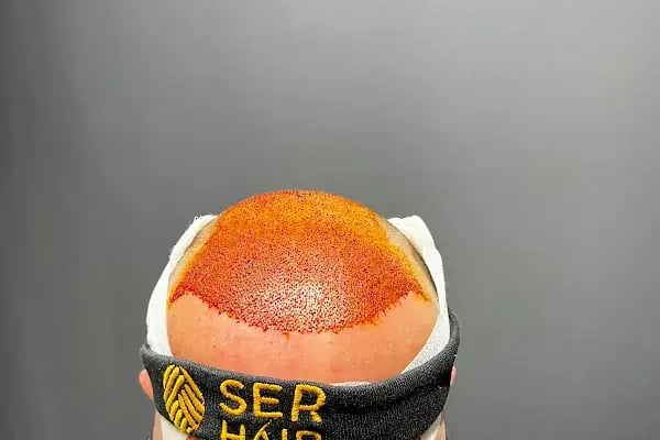 Ser Hair Center - Resim 9
