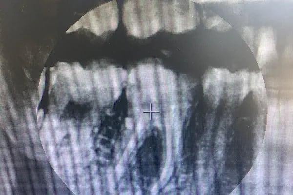 Eren Uslu Diş Kliniği - Resim 13