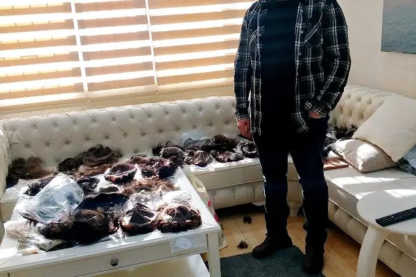 After Hair - Protez Saç Merkezi - Saç Ekim Kliniği - Resim 9