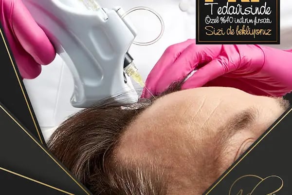 After Hair - Protez Saç Merkezi - Saç Ekim Kliniği - Resim 19