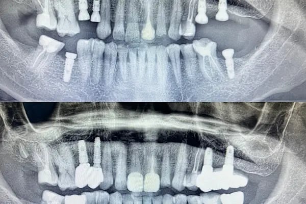 Alanya PetraDent Ağız ve Diş Sağlığı Polikliniği - Resim 4