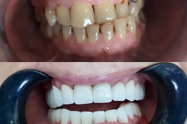 İrem Çarşı Diş Kliniği - Dentaem - Resim 18