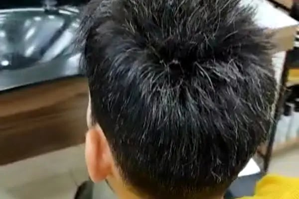 ECESSA BURSA PROTEZ SAÇ MERKEZİ - Resim 20