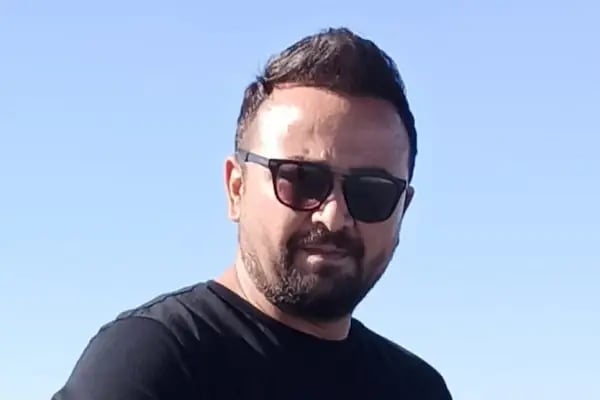 Ankara Saç Ekimi (Naturelhair) - Resim 2