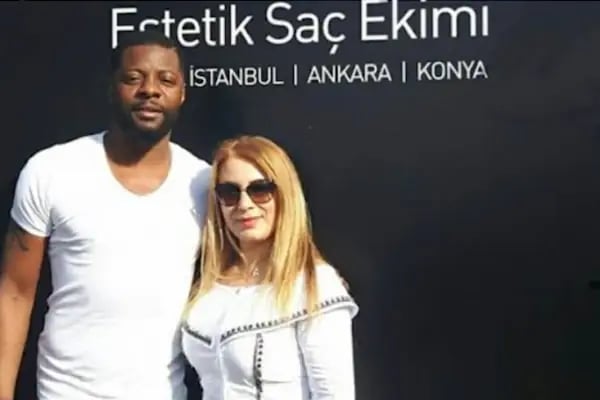 Ankara Saç Ekimi (Naturelhair) - Resim 6