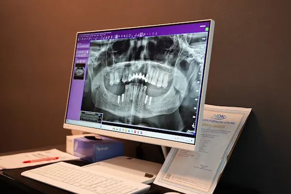 Özel Dentsun Diş Polikliniği 7/24 Karşıyaka - Resim 8