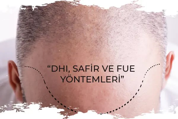 Avicenna Hastanesi Ataşehir - Resim 16