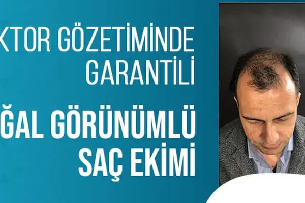Tunalı Saç Ekimi I Ankara Saç ekimi - Resim 8