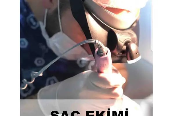 Tunalı Saç Ekimi I Ankara Saç ekimi - Resim 7