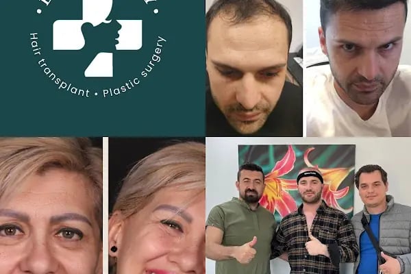 Este in Turkey | Hair Transplant - Plastic Surgery - Resim 6