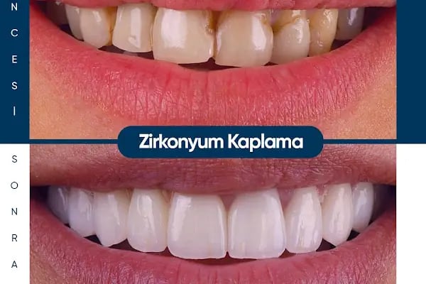 Özel Mirza Diş 2 - Diş Kliniği - Resim 9