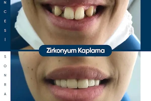 Özel Mirza Diş 2 - Diş Kliniği - Resim 8