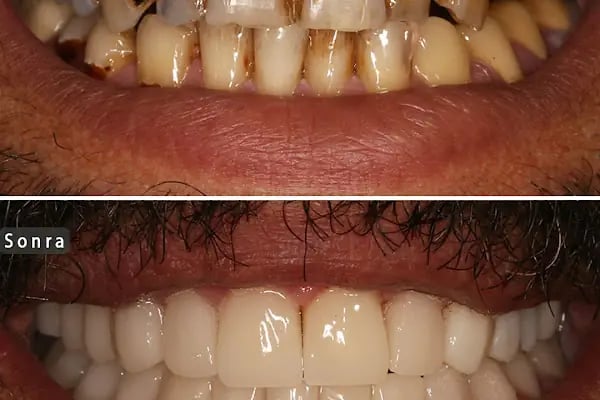 Diş Hekimi Dt. Aysun YILDIZHAN Ağız ve Diş Sağlığı Kliniği - Resim 4
