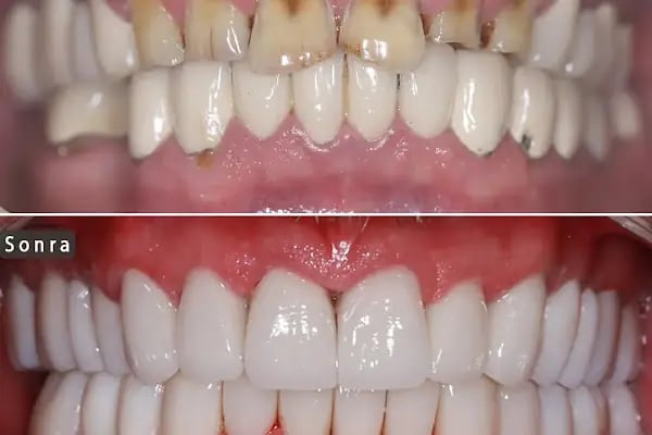 Diş Hekimi Dt. Aysun YILDIZHAN Ağız ve Diş Sağlığı Kliniği - Resim 1