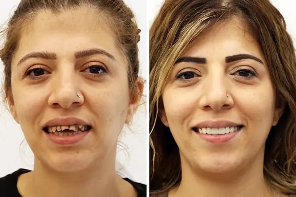 Diş Hekimi Dt. Aysun YILDIZHAN Ağız ve Diş Sağlığı Kliniği - Resim 5