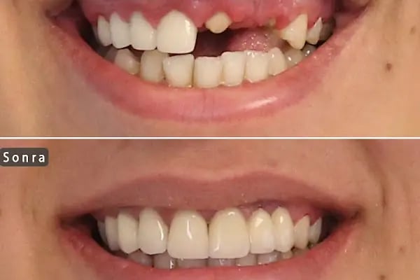 Diş Hekimi Dt. Aysun YILDIZHAN Ağız ve Diş Sağlığı Kliniği - Resim 2