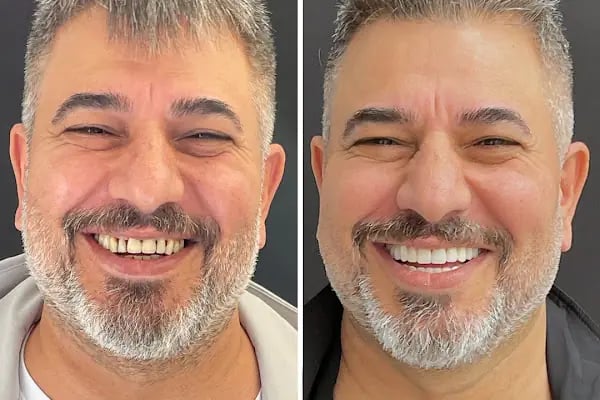 Diş Hekimi Dt. Aysun YILDIZHAN Ağız ve Diş Sağlığı Kliniği - Resim 6