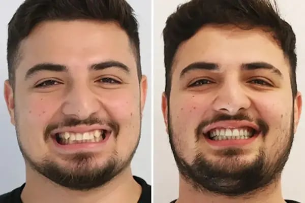 Diş Hekimi Dt. Aysun YILDIZHAN Ağız ve Diş Sağlığı Kliniği - Resim 7