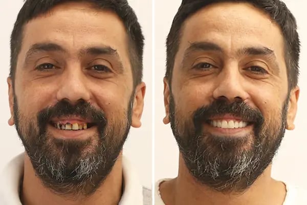 Diş Hekimi Dt. Aysun YILDIZHAN Ağız ve Diş Sağlığı Kliniği - Resim 9