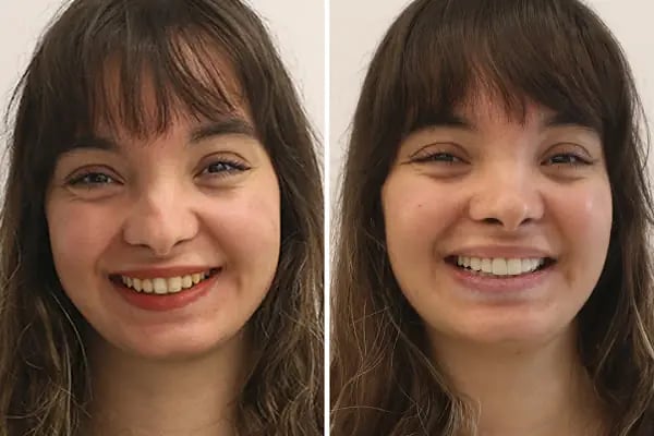 Diş Hekimi Dt. Aysun YILDIZHAN Ağız ve Diş Sağlığı Kliniği - Resim 12