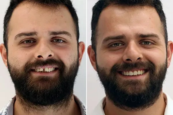 Diş Hekimi Dt. Aysun YILDIZHAN Ağız ve Diş Sağlığı Kliniği - Resim 11