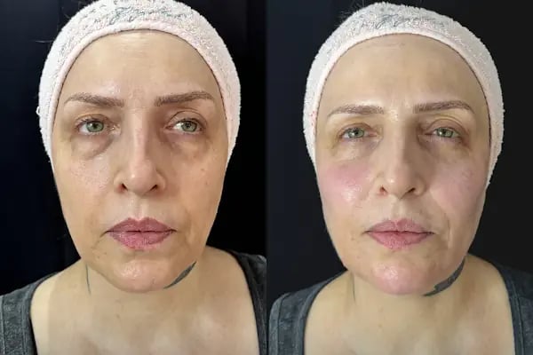 Flora Klinik Estetik Merkezi - Resim 15