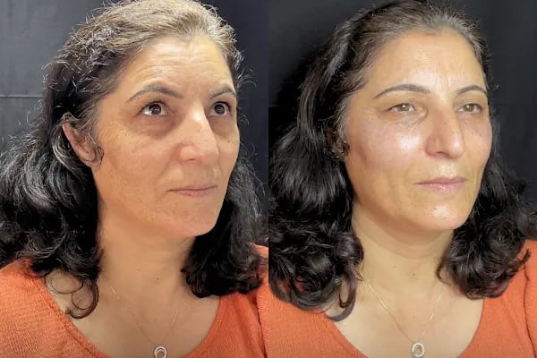 Flora Klinik Estetik Merkezi - Resim 3