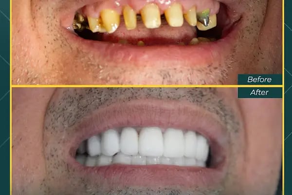 Oskar Smile Poliklinik - Resim 13