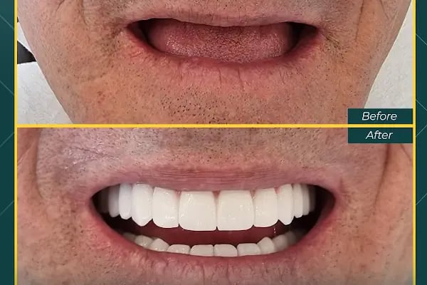 Oskar Smile Poliklinik - Resim 12