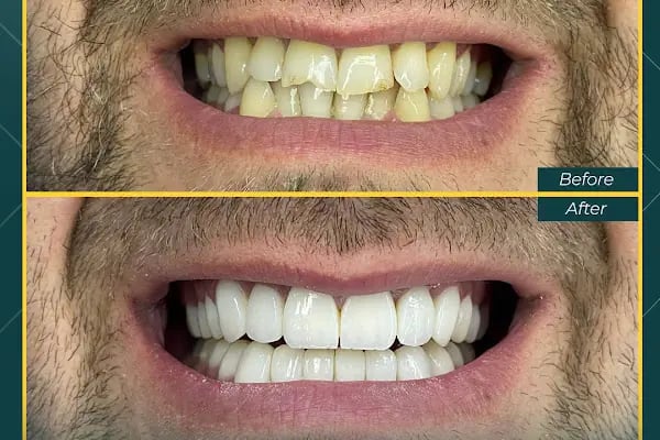 Oskar Smile Poliklinik - Resim 17
