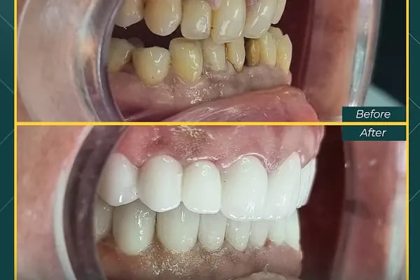 Oskar Smile Poliklinik - Resim 14
