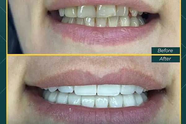 Oskar Smile Poliklinik - Resim 18