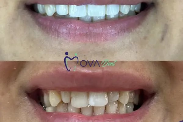 Alanya OvaDent Dental Clinic - Resim 13