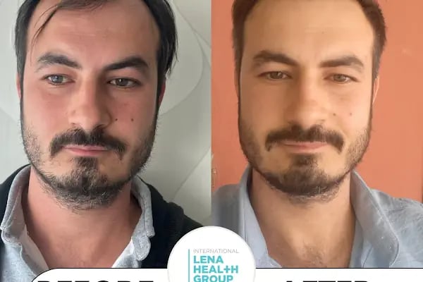Clinicizmir Lena Health Group - Resim 15