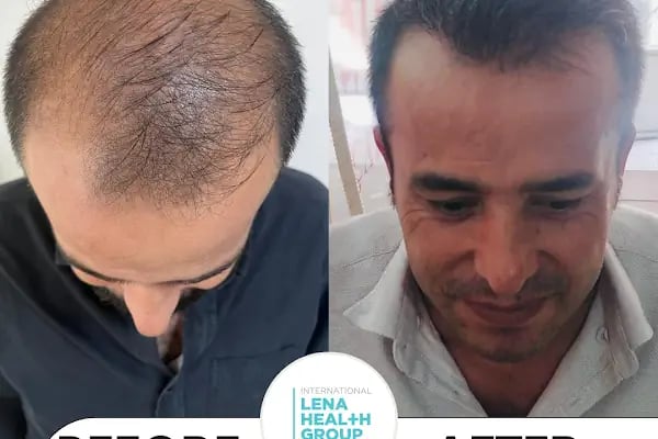 Clinicizmir Lena Health Group - Resim 19